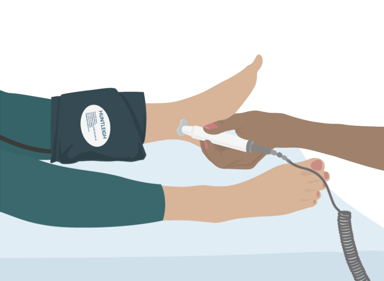 Ankle Brachial Pressure Index Assessments
