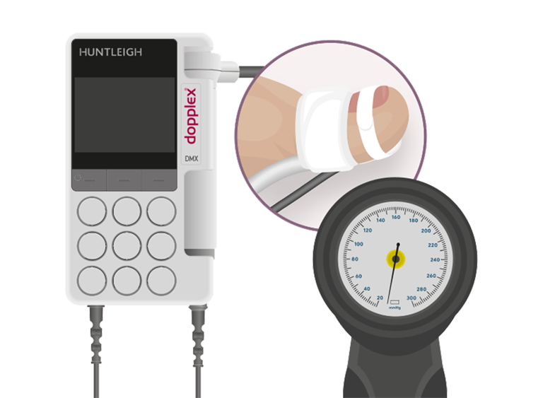 Toe Brachial Pressure Index Assessments